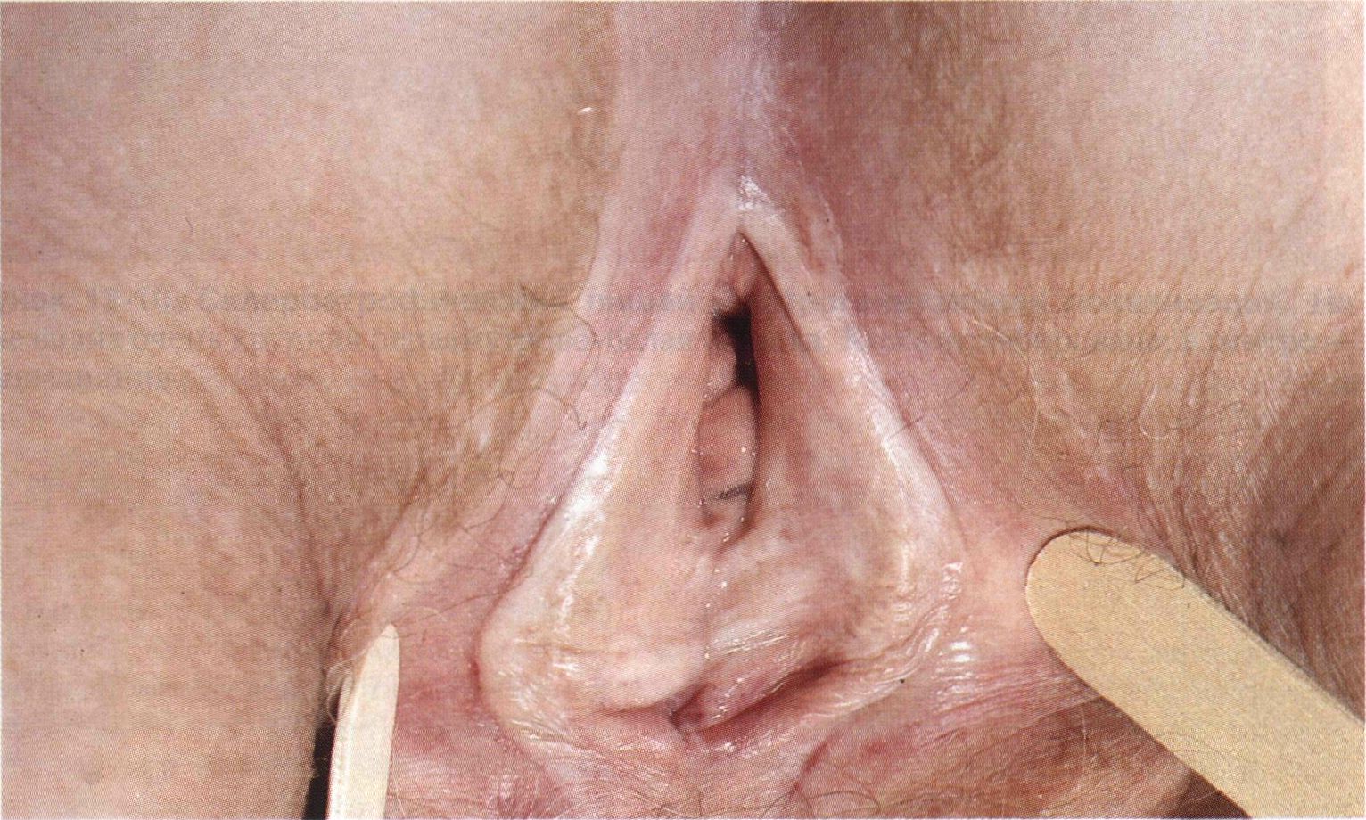 Мужик смотрит на большие половые губы жены фото