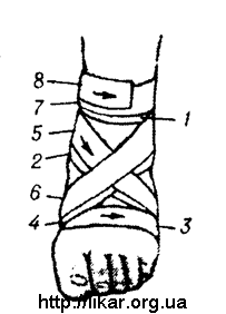 Повязка На Ногу Фото
