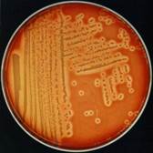 сахаролитические свойства бактерий можно определить с помощью