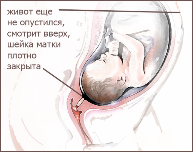 39 недель головка. Ребенок опустился в таз. Готовая шейка матки к родам. Раскрытие матки перед родами.