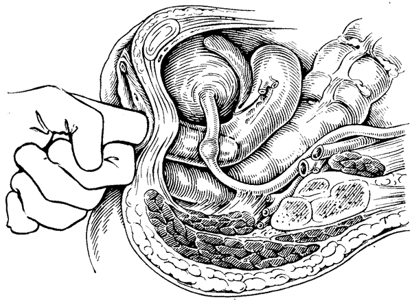 Пальцевое исследование per rectum. Пальцевое исследование шейки матки. Пальпация мочевого пузыря.