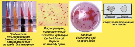 Разрыв среды. Эшерихии бактериологический метод. Микробиологическая диагностика Escherichia coli. Посев кишечной палочки Эндо. Кишечные палочки питательные среды для выделения.