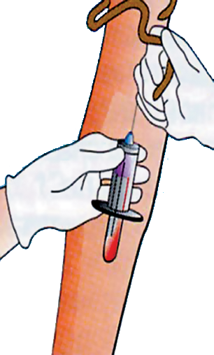 Техника взятия крови вакуумной системой. Взятие крови из периферической вены с помощью вакуумной системы. Пробирки для взятие крови из периферической вены. Взятие крови из периферической вены шприцем.