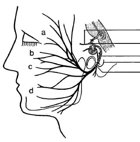 2 лицевой нерв. Лицевой нерв околоушная железа. Лицевой нерв анатомия топография. Лицевой нерв анатомия топография схема. Лицевой нерв в околоушной железе.