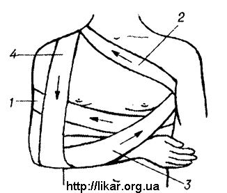 Повязка на молочную железу. Повязка Дезо схема. Повязка на подмышечную впадину. Бинтовая повязка на подмышечную впадину детям. Пластырная повязка накладывание на подмышечную впадину.
