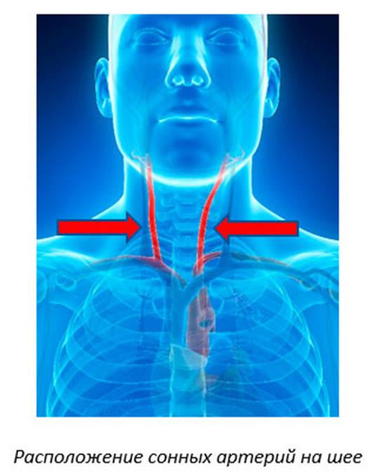 Сонные артерии на шее человека фото. Сонная артерия на шее расположение. Где находится Сонная Артель. Где находится сонар арткрии.