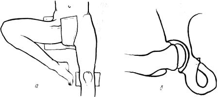 Изображение - Рентгенография тазобедренных суставов по лаунштейну image445