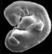 Патология жабер у человека. Жаберные щели у зародыша человека. Жаберные щели у эмбриона человека. Жабры у человеческого эмбриона.