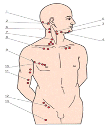 Лимфоузел справа у мужчины. Подключичные лимфоузлы расположение схема. Схема пальпации лимфатических узлов. Периферические подключичные лимфоузлы. Периферические лимфоузлы схема.
