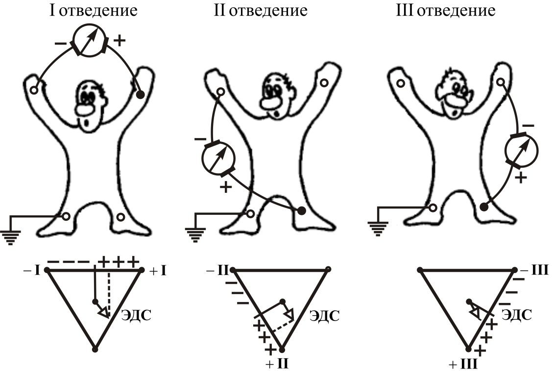 12 отведений экг схема