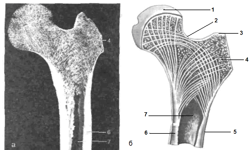 Внутренняя поверхность костей. Костная структура головки бедренной кости. Бедренная кость метафиз. Строение головки бедренной кости. Строение бедренной кости на распиле.