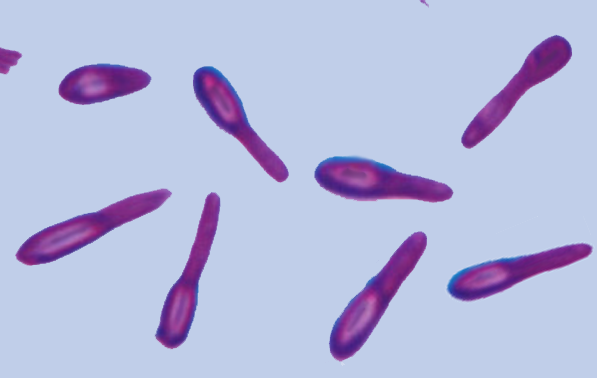 Кластридии. Маслянокислые бактерии рода Clostridium. Клостридии бутирикум. Clostridium pasteurianum микроскоп. Clostridium botulinum микроскоп.