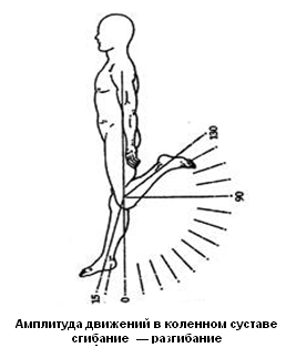 Ограничение движения в коленном суставе