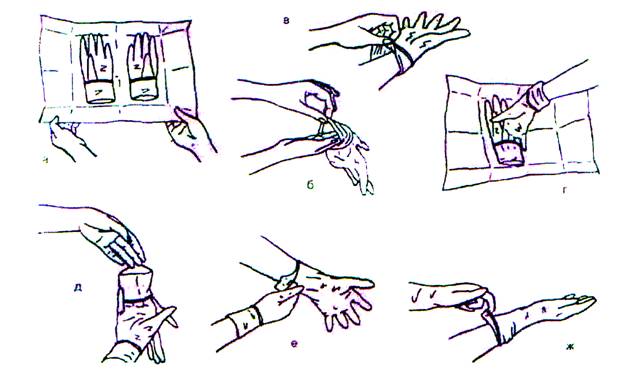Алгоритм стерильных перчаток. Одевание стерильных перчаток алгоритм. Техника одевания стерильных перчаток алгоритм. Алгоритм надевания стерильных медицинских перчаток.. Схема снятия стерильных перчаток.