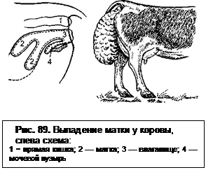 Выпад матки