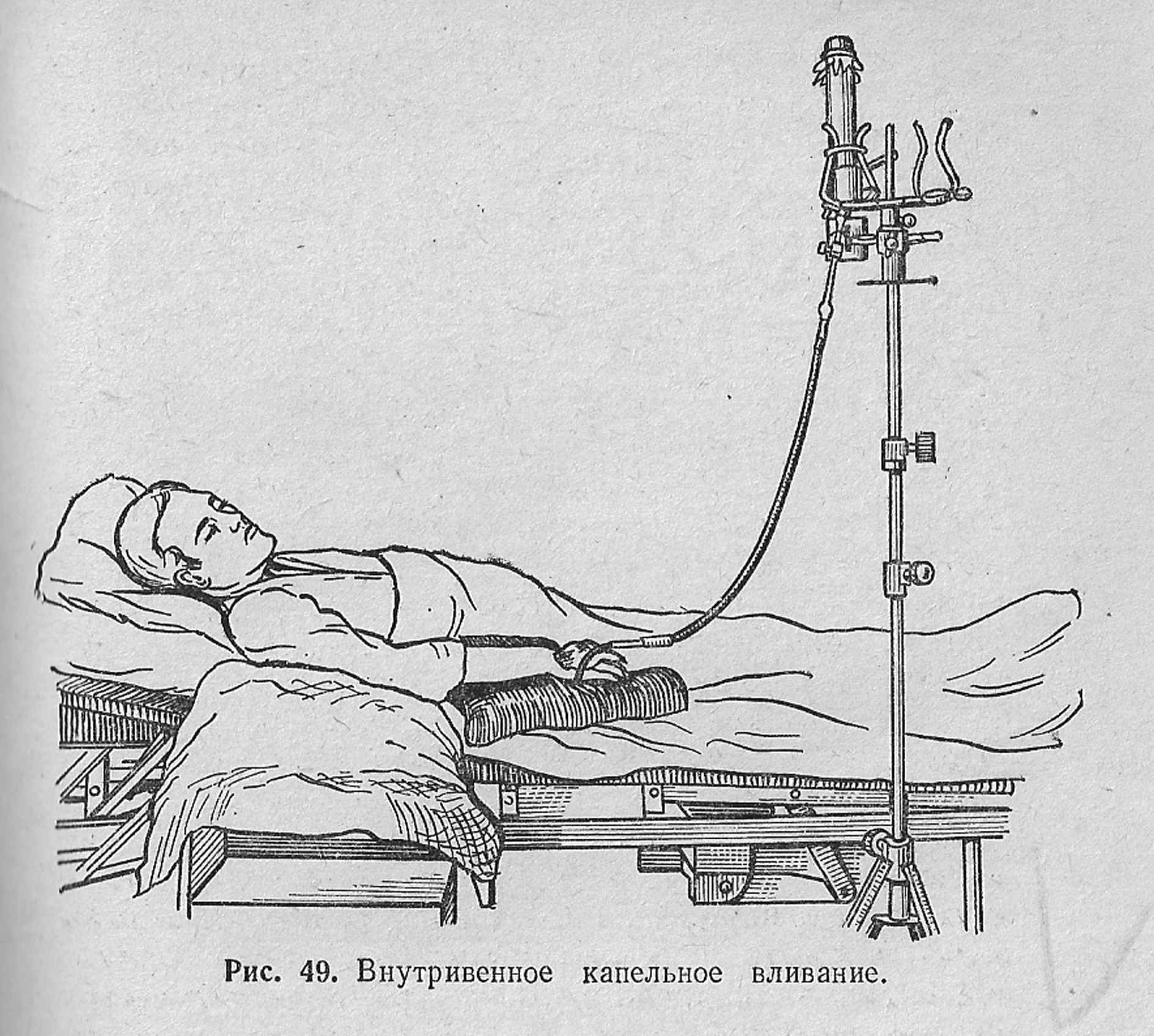 Заполнение внутривенной системы алгоритм. Алгоритм выполнения оксигенотерапии внутривенно. Внутривенное капельное Введение. Внутривенно капельное ввливание. Алгоритм Введение капельного вливания.