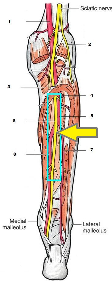 Груберов канал. Canalis cruropopliteus анатомия. Верхний мышечно малоберцовый канал топография. Каналы голени топографическая анатомия. Стенки верхнего мышечно-малоберцового канала.