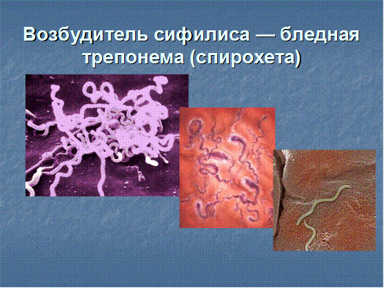 Бледная трепонема treponema pallidum. Treponema pallidum микробиология. Бледная спирохета морфология. Бледная трепонема морфология. Сифилис эпидемиология бледная спирохета.