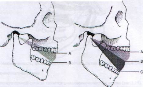 Мыщелки нижней челюсти