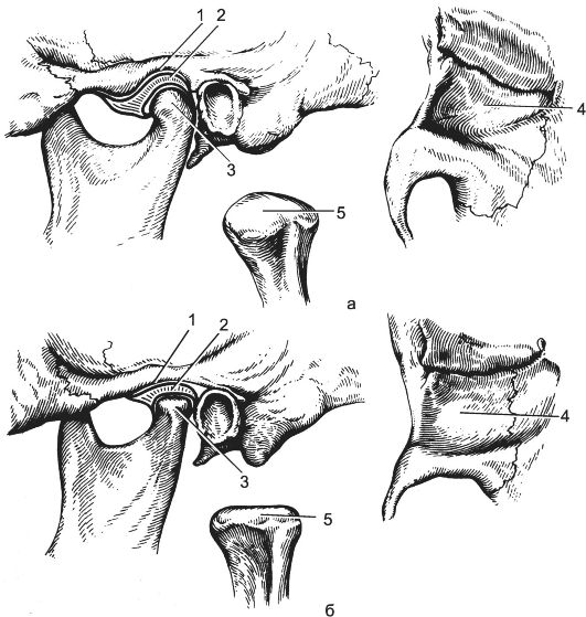Мыщелки нижней челюсти