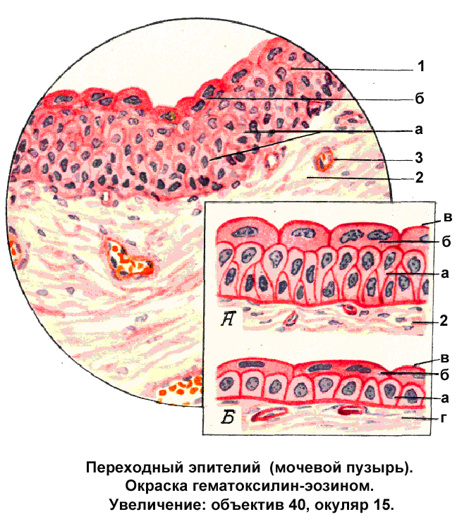 Слои переходного эпителия. Многослойный переходный эпителий уротелий. Клетки переходного эпителия мочевого пузыря. Переходный эпителий мочевого пузыря. Эпителий мочевого пузыря гистология.