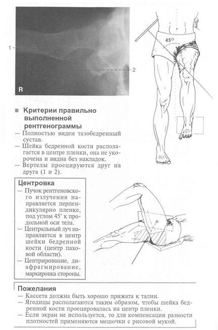 Как делается рентген тазобедренного сустава у женщин фото пошагово