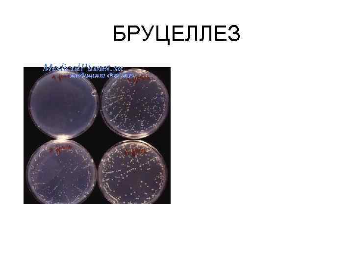 Кольцевая реакция. Реакция агглютинации Райта при бруцеллезе. Реакция Райта бруцеллез. Реакция Райта-хеддельсона. Реакция хеддельсона на бруцеллез микробиология.