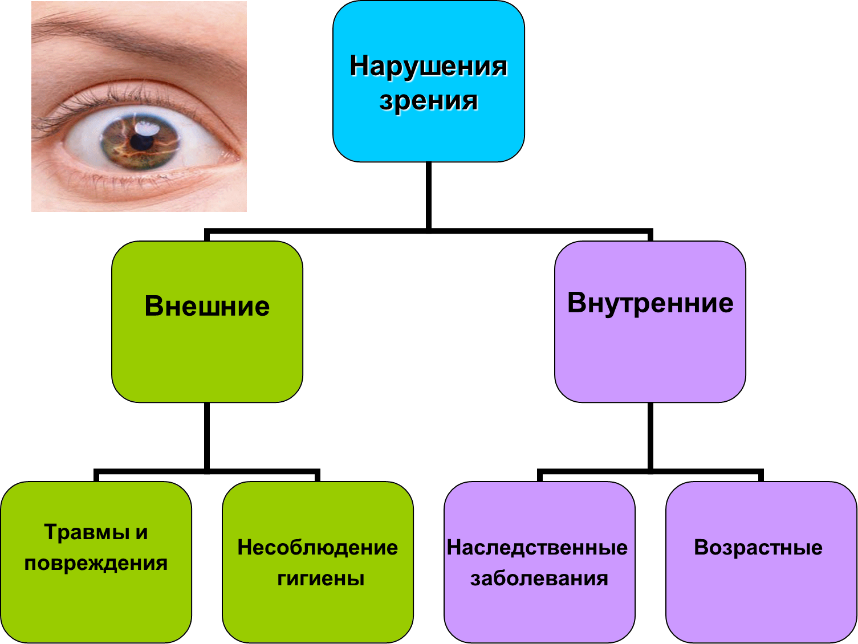Классификация нарушений зрения схема. Врожденные причины нарушения зрения. Классификация детей с нарушением зрения. Классификация нарушения зрения у детей таблица.