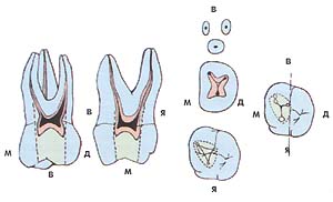 Сколько каналов в 16. Анатомия каналов верхних моляров. Анатомия корневых каналов моляров верхней челюсти. Первый моляр верхней челюсти каналы. Анатомия корневых каналов первого моляра верхней челюсти.