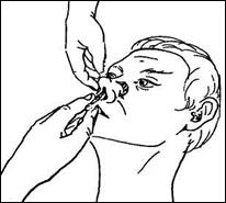 Обработка полости рта пациента. Закладывание мази в нос алгоритм. Обработка полости носа тяжелобольному пациенту.