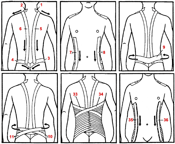 Схемы тейпирования спины