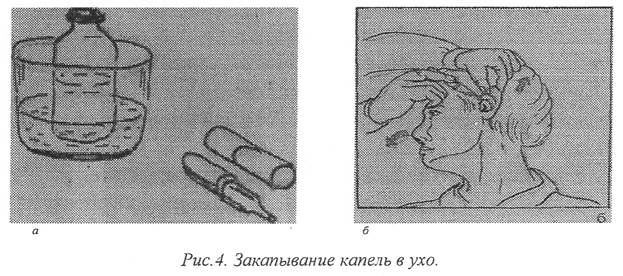 Носовая канюля алгоритм. Оксигенотерапия через носовую канюлю. Проведение оксигенотерапии через носовой катетер.