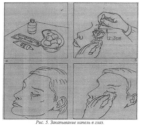 Техника туалета глаз и введение капель в глаза детям