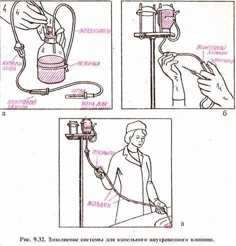 Заполнение внутривенной системы алгоритм. Алгоритм сбора системы для внутривенного капельного вливания. Устройство системы для внутривенного капельного вливания схема. Заполнение системы для внутривенного капельного вливания алгоритм. Внутривенное капельное Введение жидкости.