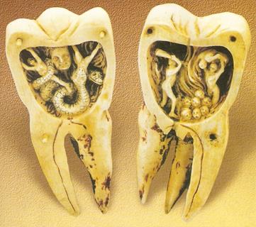 Реферат: Теории происхождения кариеса зубов