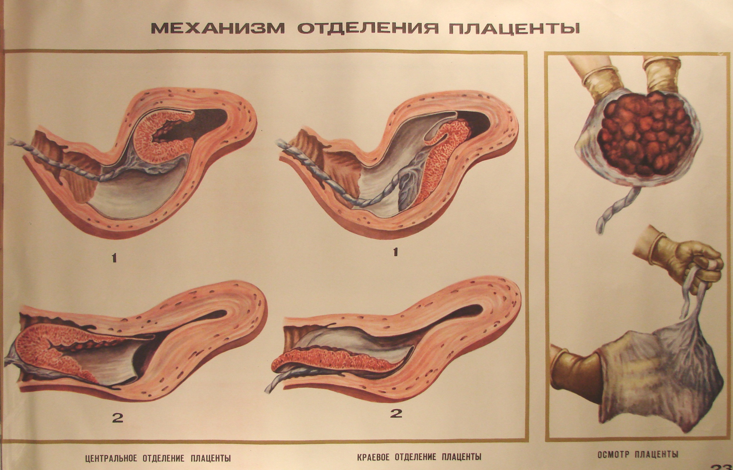 Цвет Матки Перед Месячными