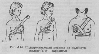 Повязка на молочную железу. Наложение повязки на молочную железу.