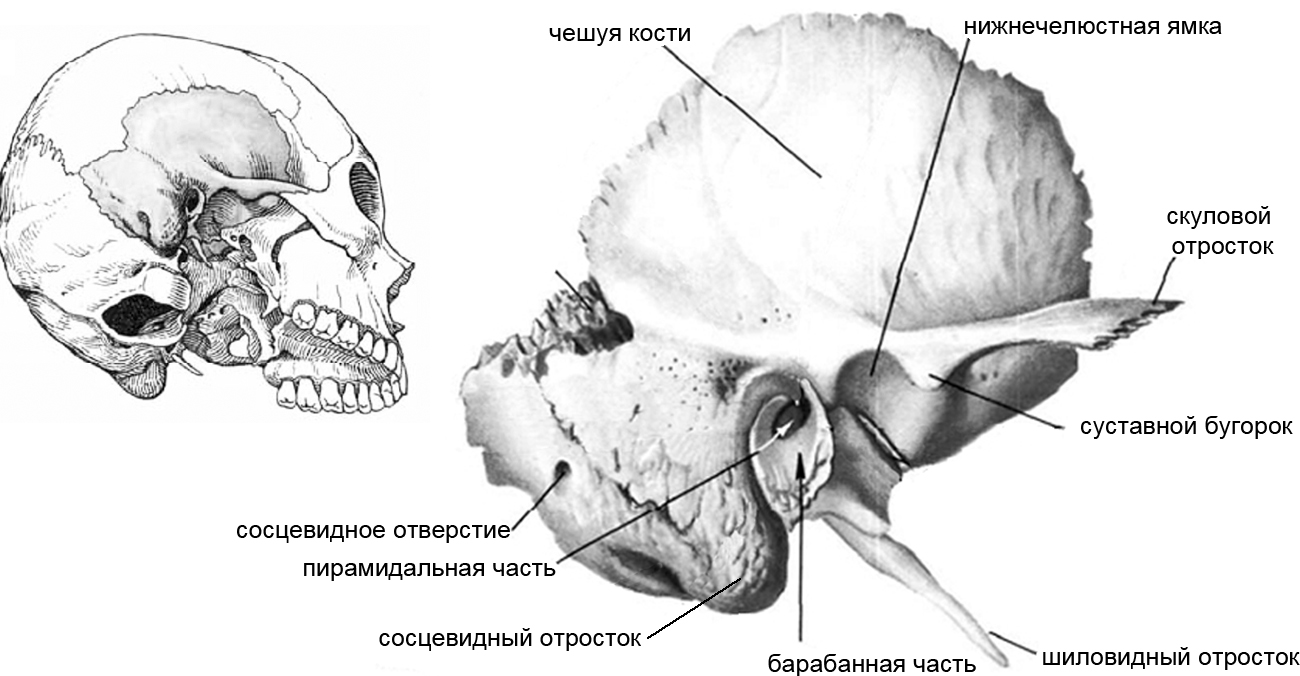 Изменения височной кости. Скуловой отросток височной кости на черепе. Височная кость черепа анатомия. Сосцевидный отросток анатомия. Отросток височной кости антропология.