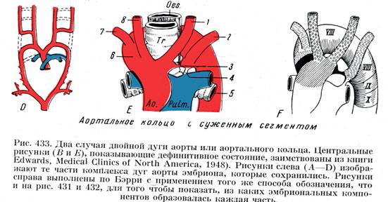 Рассмотрите схему сосудов дуги аорты сделайте к рисунку необходимые обозначения