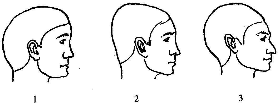 Наклоненный лоб. Формы головы человека сбоку. Криминалистическая габитология форма головы. Форма теменной части головы. Форма черепа человека сбоку.