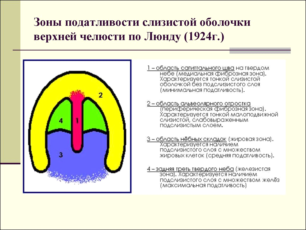 Классификация суппле картинки