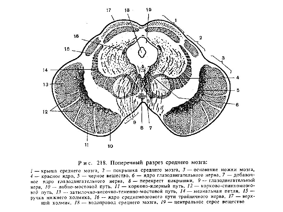 Поперечный срез моста головного мозга схема