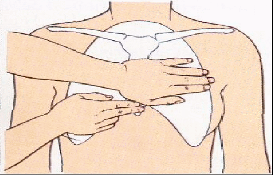 Сжатие груди