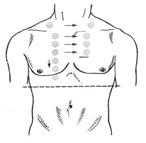Резистентность грудной. Пальпация грудной клетки исследование резистентности. Определение резистентности грудной клетки. Сравнительная перкуссия межреберья. Методика пальпации молочных желез.